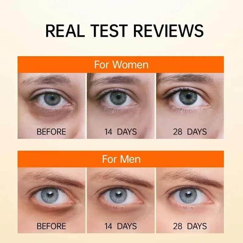 Retinol Eye Serum – Anti-Dark Circle, Anti-Wrinkle