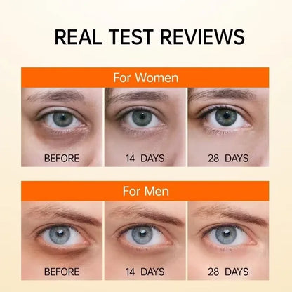 Retinol Eye Serum – Anti-Dark Circle, Anti-Wrinkle