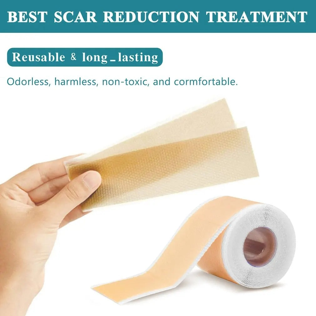 4cm x 150cm Silicone Scar Sheets Roll – Waterproof Self-Adhesive Scar Tape