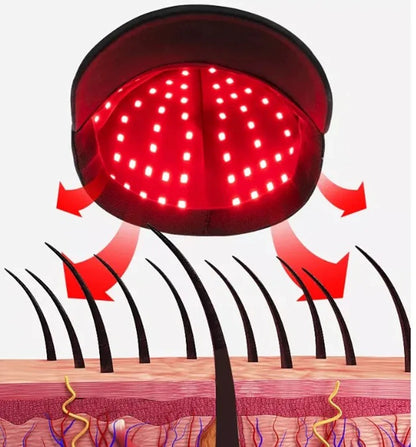 660nm & 850nm Red Light Therapy Hair Growth Cap