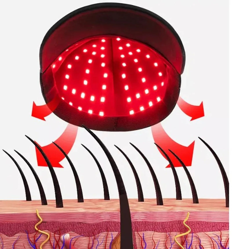 660nm & 850nm Red Light Therapy Hair Growth Cap