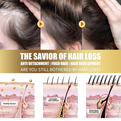 Anti-Dandruff Exfoliating Scalp Scrub – Anti-Itch & Oil Control Treatment