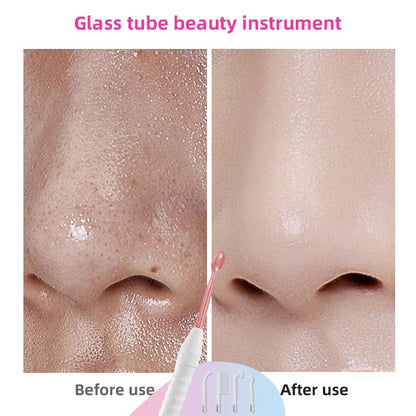 High Frequency Facial Wand with Neon & Argon Electrodes