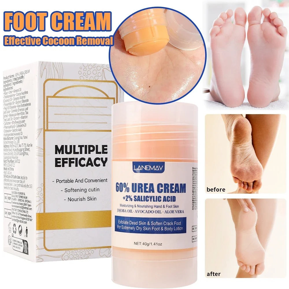 Urea Foot Cream – Dry & Cracked Heel Repair, Exfoliating & Ultra-Hydrating Care