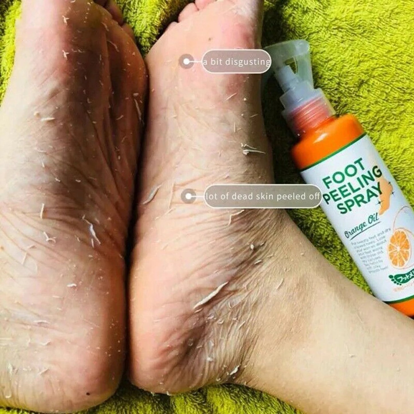 Foot Peeling Spray – Rough Skin Remover [110ml]