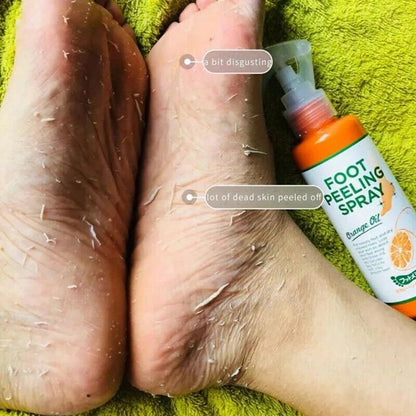 Foot Peeling Spray – Rough Skin Remover [110ml]