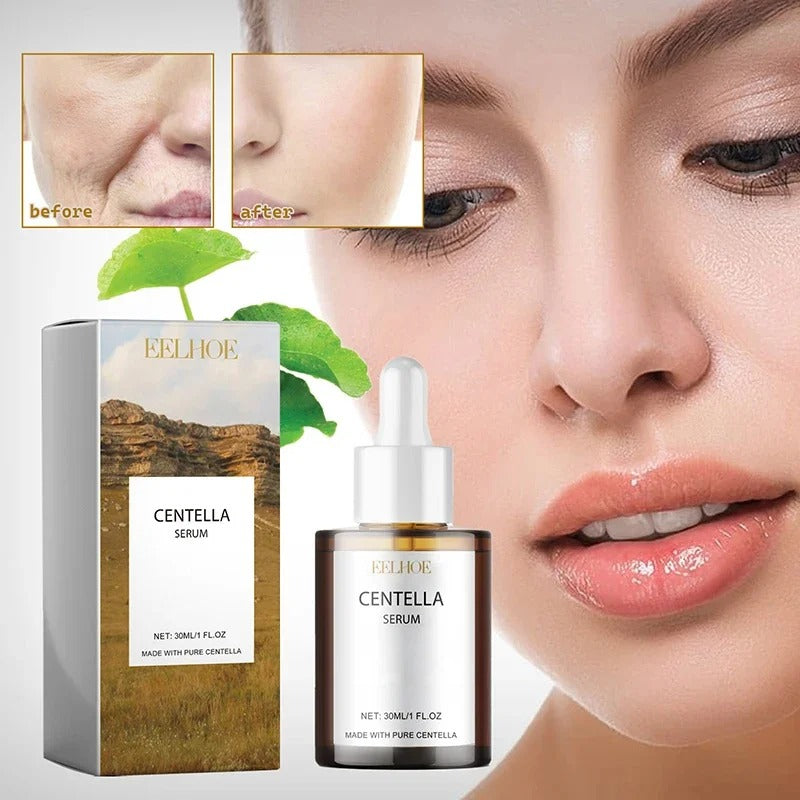 Centella Asiatica Face Serum – Hydrating, Brightening & Skin Repair [30mL]