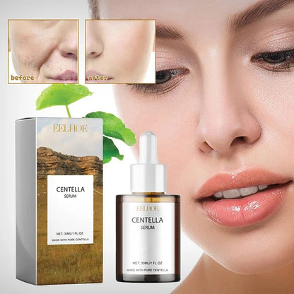 Centella Asiatica Face Serum – Hydrating, Brightening & Skin Repair [30mL]