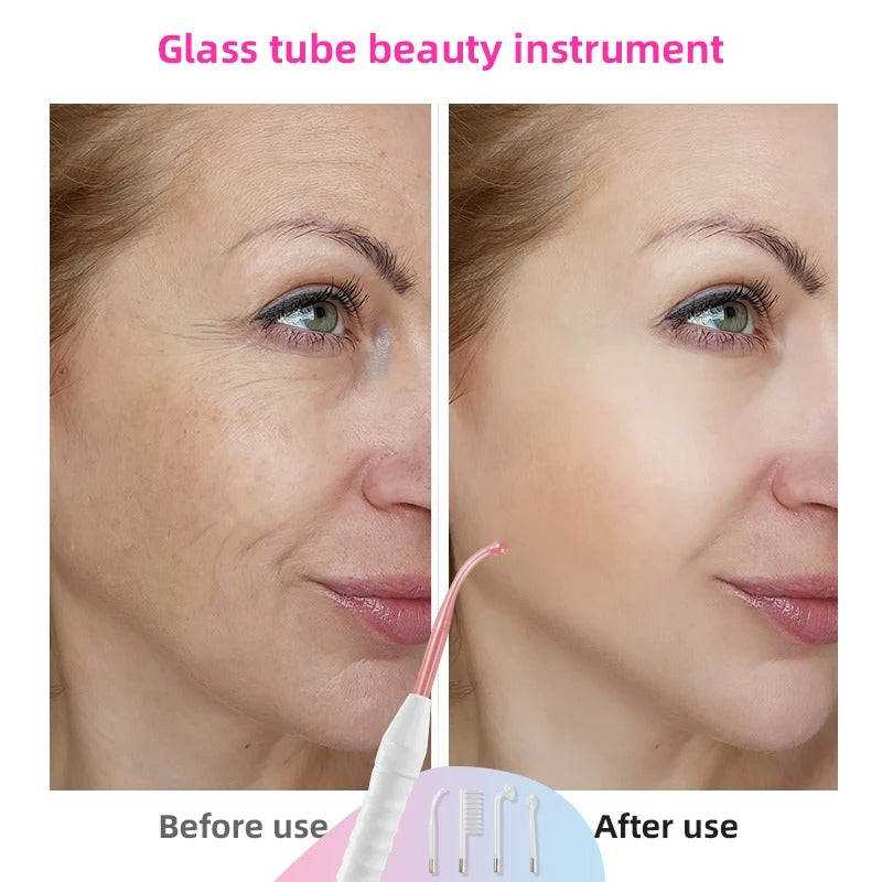 High Frequency Facial Wand with Neon & Argon Electrodes