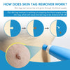 2-in-1 Auto Skin Tag Remover Kit for Moles, Warts & Stains
