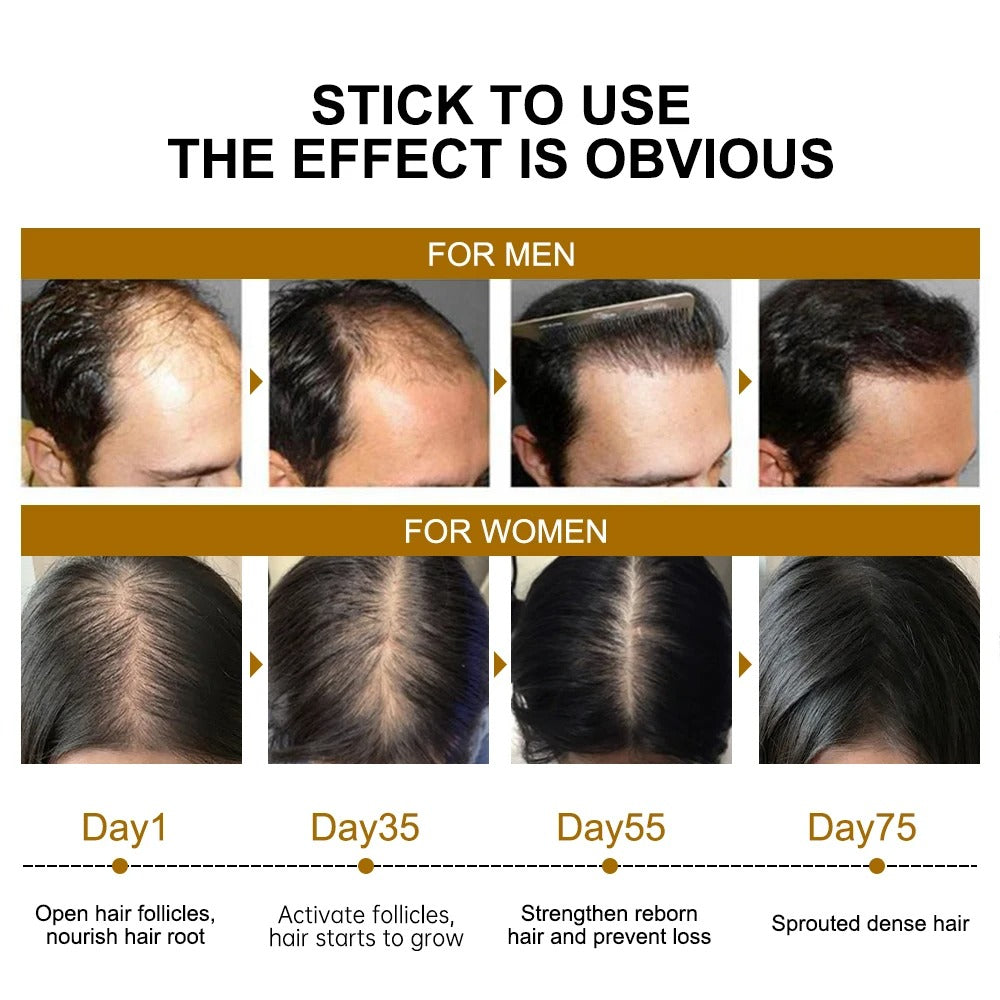 Biotin Hair Growth Serum for Fast Regrowth and Thicker Hair
