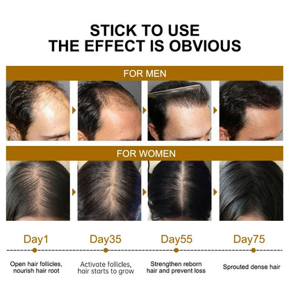 Biotin Hair Growth Serum for Fast Regrowth and Thicker Hair