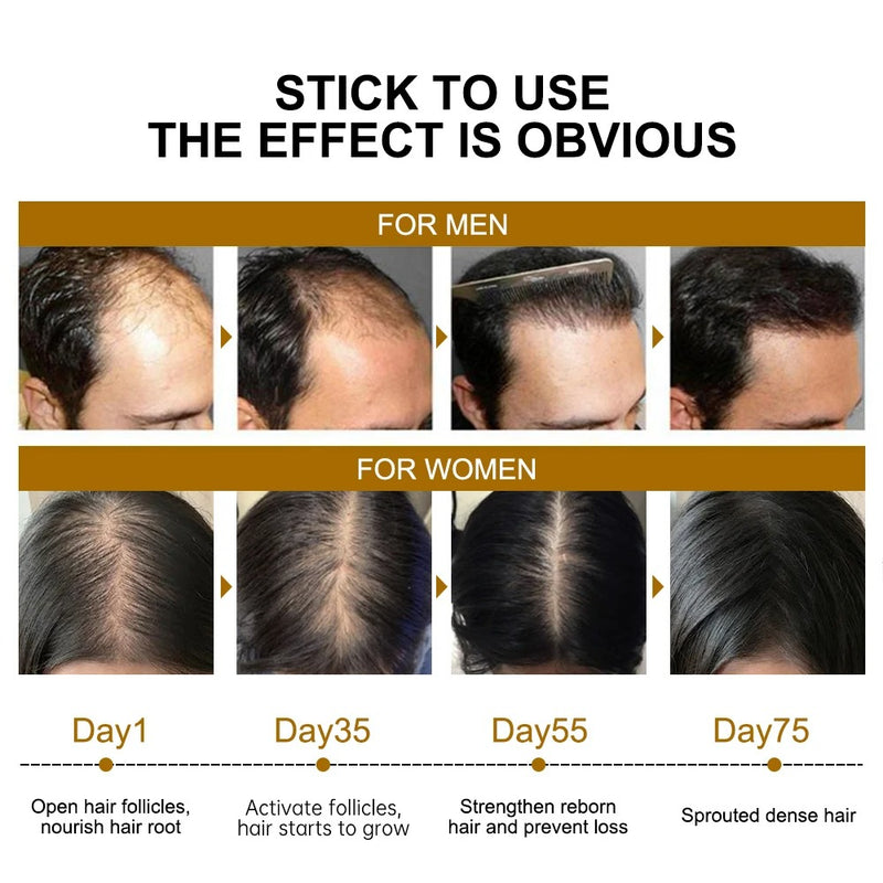 Biotin Hair Growth Serum for Fast Regrowth and Thicker Hair