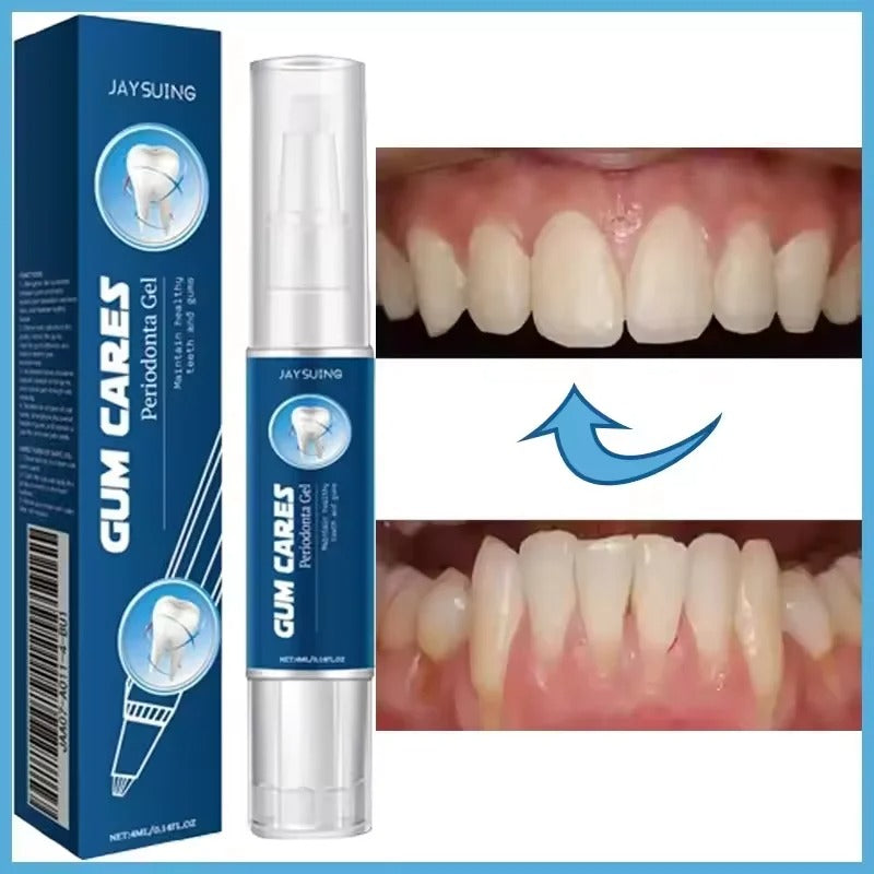 Gum Repair Gel for Sensitive Gums and Tartar Removal