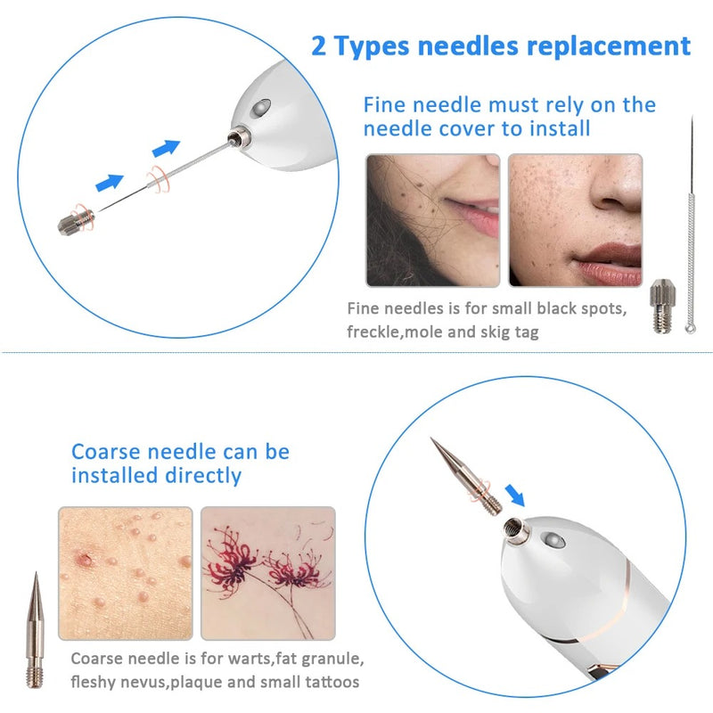 Laser Plasma Skin Tag Remover Pen Mole Freckle Eliminator