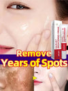 Whitening Freckles Face Cream