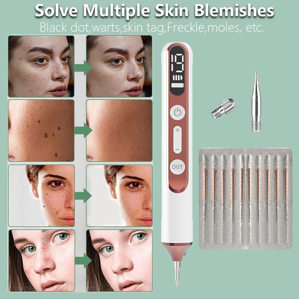 Plasma Pen Skin Tag Mole Wart Freckle Removal Device - RESTORALUX