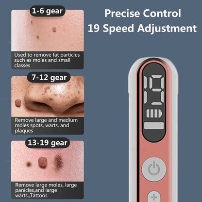 Plasma Pen Skin Tag Mole Wart Freckle Removal Device - RESTORALUX