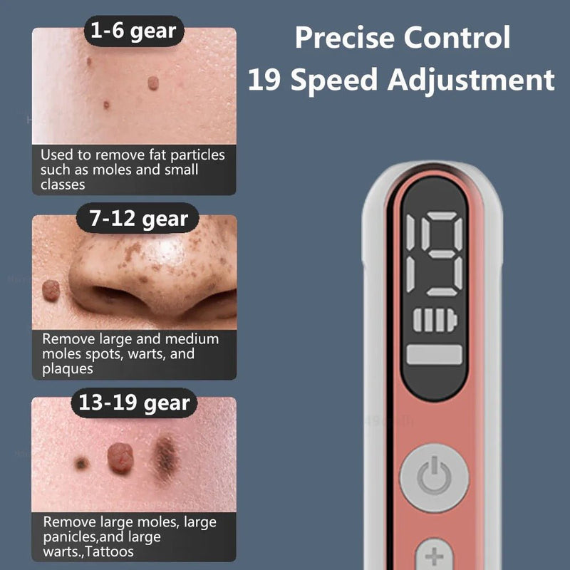 Plasma Pen Skin Tag Mole Wart Freckle Removal Device - RESTORALUX