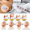 Plasma Pen Skin Tag Mole Wart Freckle Removal Device - RESTORALUX