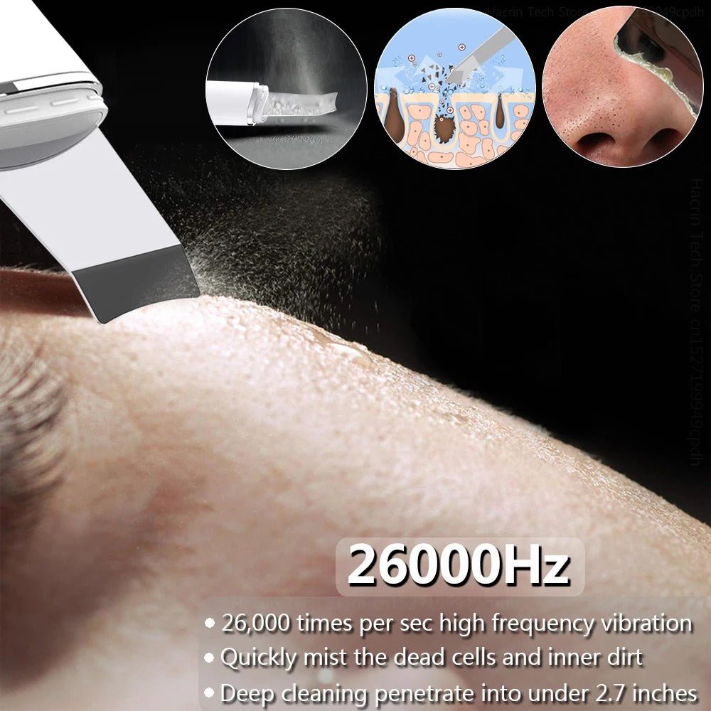 Ultrasonic Skin Scrubber Blackhead Remover Facial Pore Cleaner - RESTORALUX