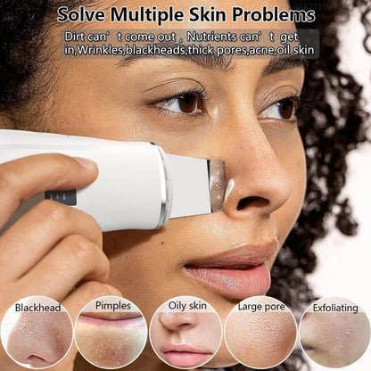Ultrasonic Skin Scrubber Blackhead Remover Facial Pore Cleaner - RESTORALUX