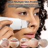 Ultrasonic Skin Scrubber Blackhead Remover Facial Pore Cleaner - RESTORALUX