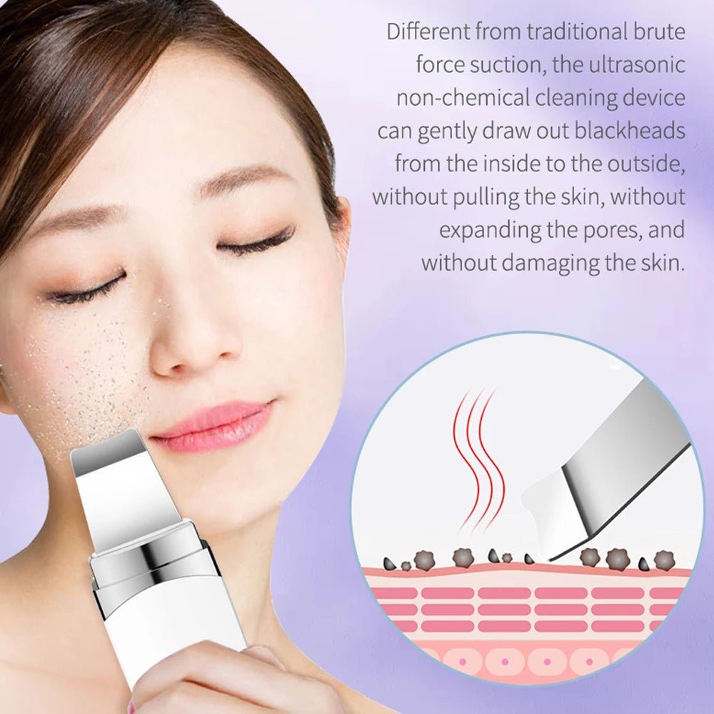 Ultrasonic Skin Scrubber Facial Spatula Blackhead Pore Cleaner - RESTORALUX